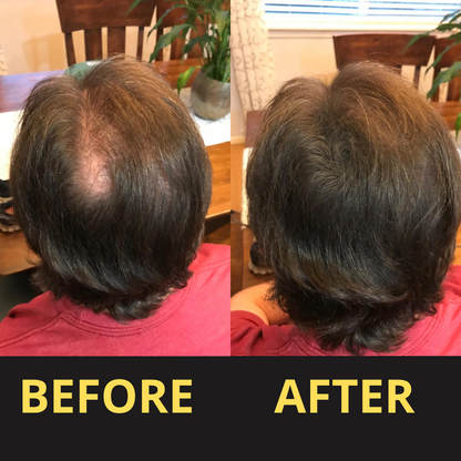 Hair Concealer BLACK 50ML - Waterproof 3–7 days.