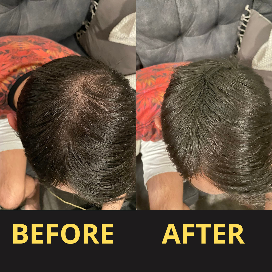 Hair Concealer BLACK 50ML - Waterproof 3–7 days.