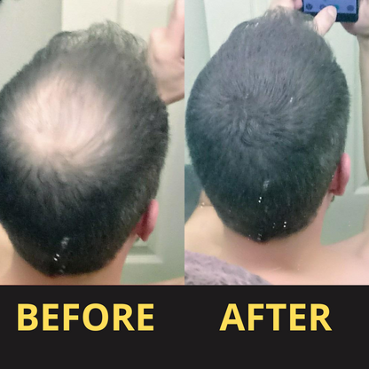 Hair Concealer BLACK 50ML - Waterproof 3–7 days.