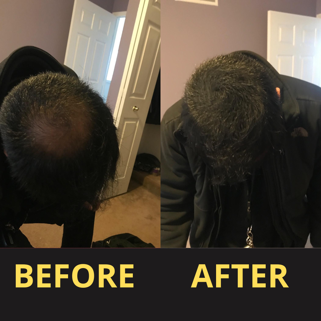 Hair Concealer BLACK 50ML - Waterproof 3–7 days.