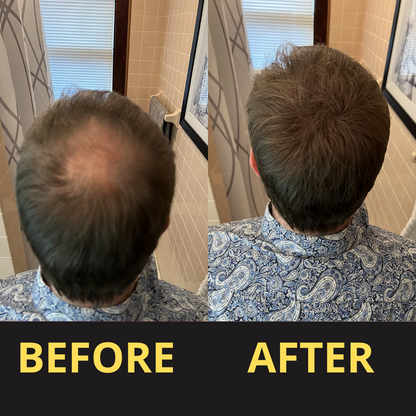 Hair Concealer BLACK 50ML - Waterproof 3–7 days.