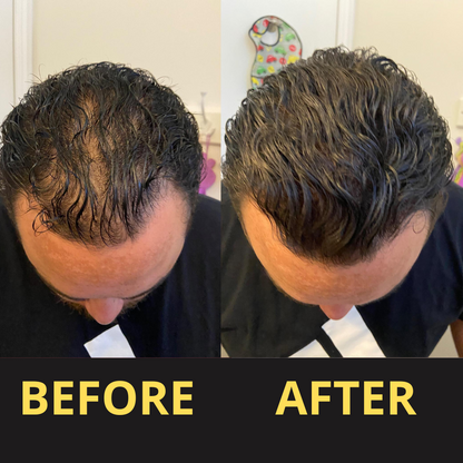 Hair Concealer BLACK 50ML - Waterproof 3–7 days.