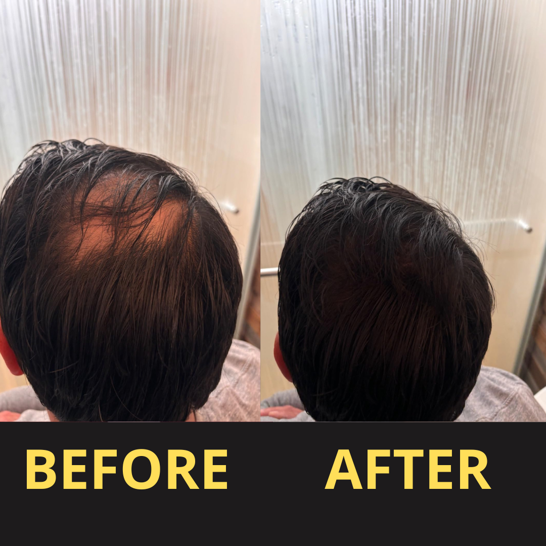 Hair Concealer BLACK 50ML - Waterproof 3–7 days.