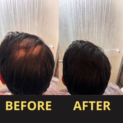 Hair Concealer BLACK 50ML - Waterproof 3–7 days.