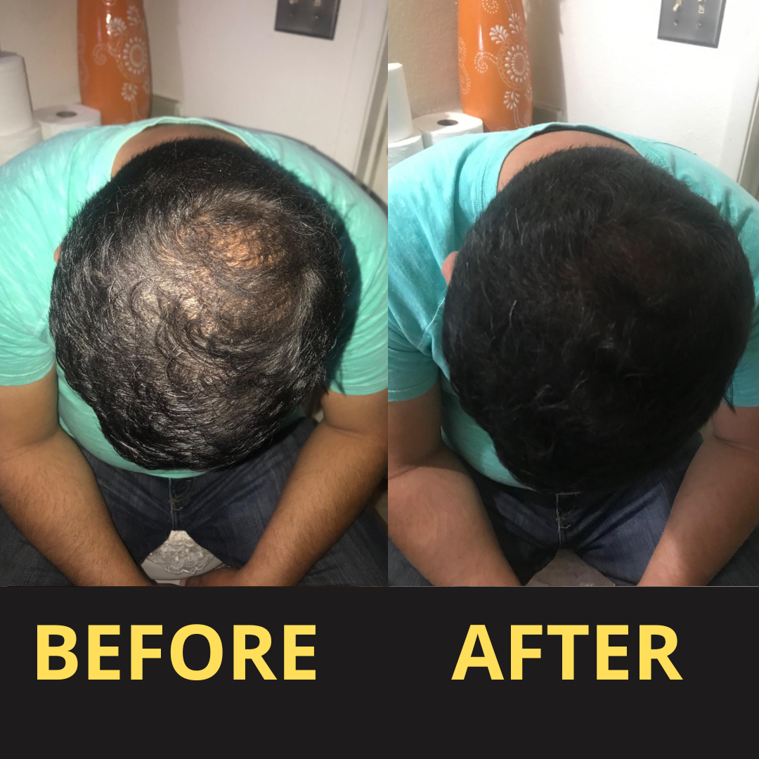 Hair Concealer BLACK 50ML - Waterproof 3–7 days.