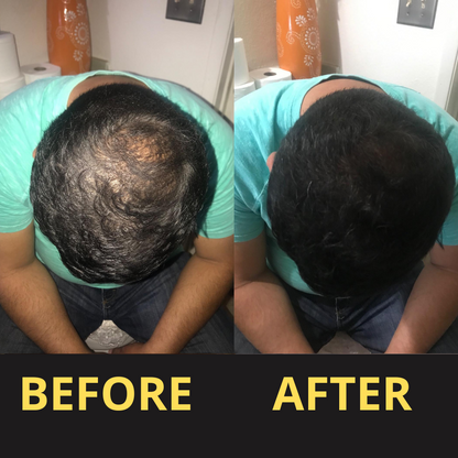 Hair Concealer BLACK 50ML - Waterproof 3–7 days.