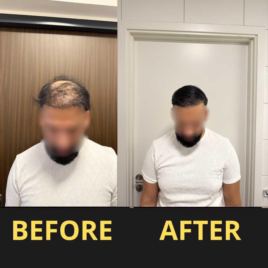 Hair Concealer BLACK 50ML - Waterproof 3–7 days.